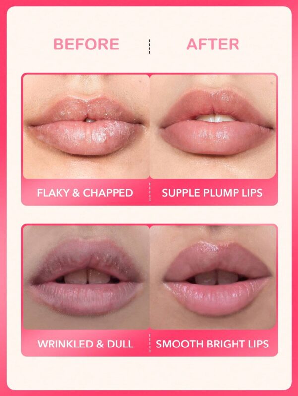SlowSunday Lip Scrub Exfoliating , Hydrating Moisturizing Revitalizing Exfoliating Facial Peel